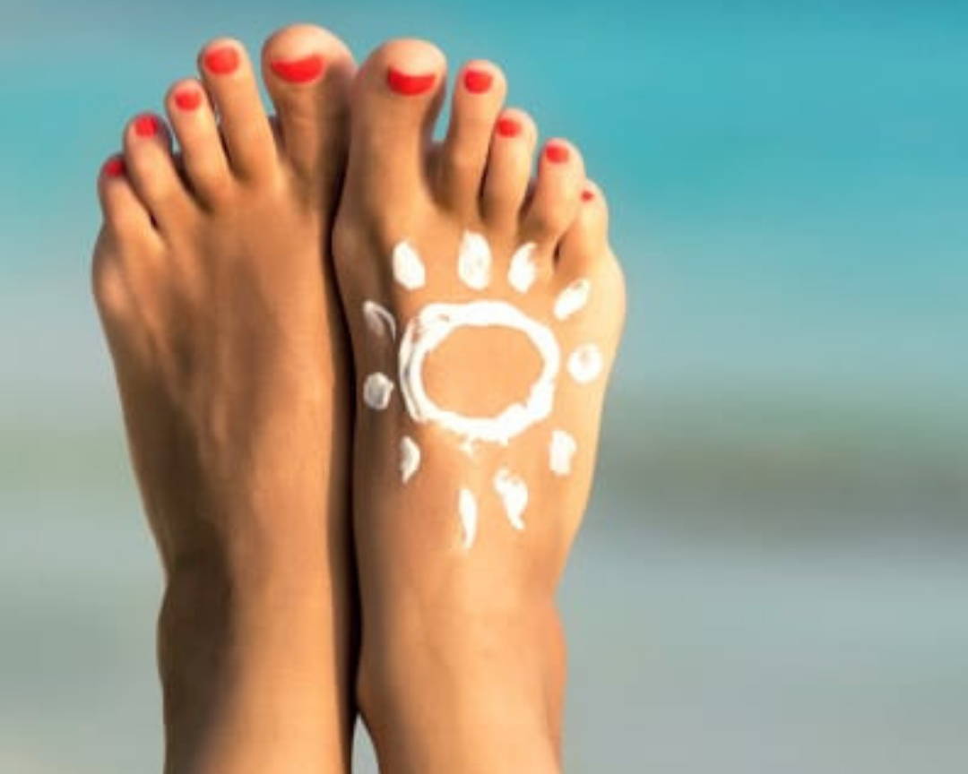 There are many areas on our body where we forget to apply sunscreen like our toes, fingers, scalp, lips and ears.